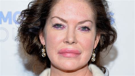 lara flynn boyle boobs|How Plastic Surgery Damaged Lara Flynn Boyles Career